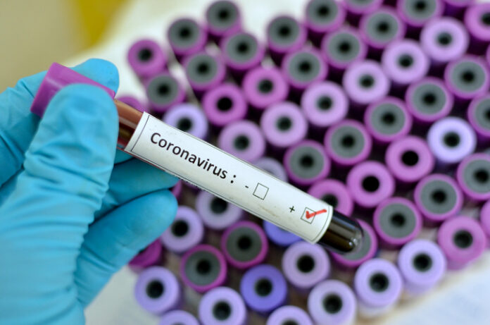 Ghana’s Coronavirus cases hit 566