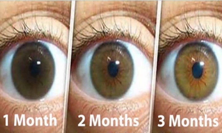 Natural Remedy for Cleaning Your Eyes and Improving Vision in Only 3 Months: Here is What You Need