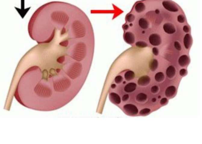 If Your Kidney Is in Danger, The Body Will Give You These 7 Signs According To Health Experts