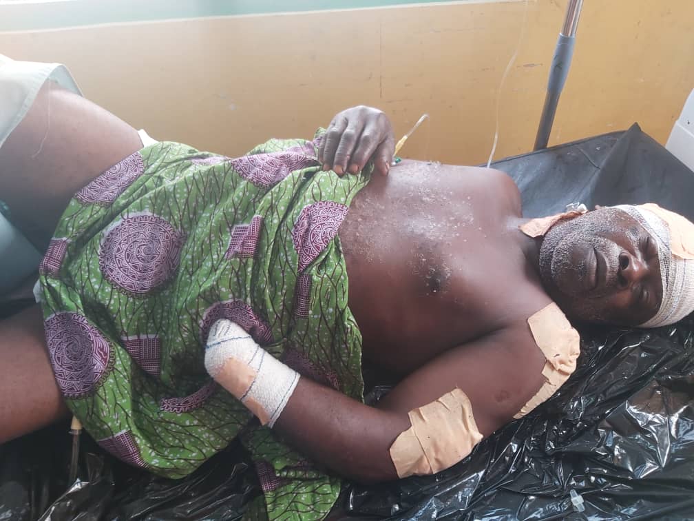 C/R: Alleged Mentally Impaired Man Butchers Father At Tumfokro